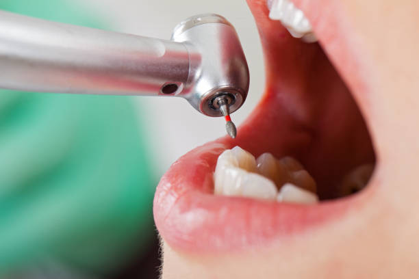 Best Emergency Gum Treatment in Worthgton, IN